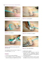 Handbook of Clinical Techniques in Pediatric Dentistry 2022 - Image 7