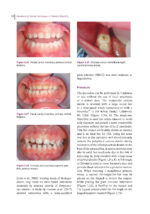 Handbook of Clinical Techniques in Pediatric Dentistry 2022 - Image 8