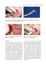 Handbook of Clinical Techniques in Pediatric Dentistry 2022 - Image 9
