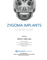 Zygoma Implants Step by Step 2023 - Image 7