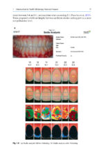 Tooth Whitening: An Evidence-Based Perspective 2023 - Image 8