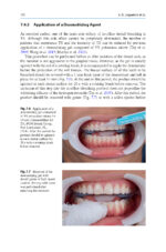 Tooth Whitening: An Evidence-Based Perspective 2023 - Image 6