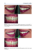 Tooth Whitening: An Evidence-Based Perspective 2023 - Image 4