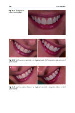 Tooth Whitening: An Evidence-Based Perspective 2023 - Image 3