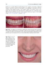 Tooth Whitening: An Evidence-Based Perspective 2023 - Image 2