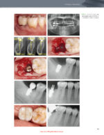 The Immediacy Concept: Treatment Planning from Analog to Digital 2022 - Image 2