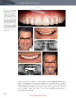 The Immediacy Concept: Treatment Planning from Analog to Digital 2022 - Image 5