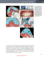 The Immediacy Concept: Treatment Planning from Analog to Digital 2022 - Image 8