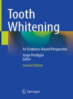 Tooth Whitening: An Evidence-Based Perspective 2023