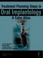 Treatment Planning Steps in Oral Implantology: A Color Atlas