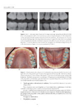 Updates on Caries Management in the Primary and Permanent Dentition 2025 - Image 5