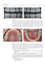 Updates on Caries Management in the Primary and Permanent Dentition 2025 - Image 5