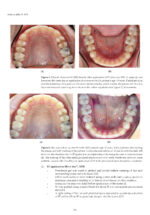Updates on Caries Management in the Primary and Permanent Dentition 2025 - Image 6