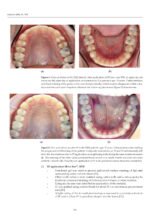 Updates on Caries Management in the Primary and Permanent Dentition 2025 - Image 6