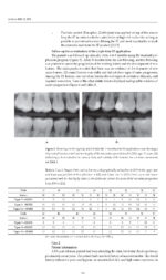 Updates on Caries Management in the Primary and Permanent Dentition 2025 - Image 7