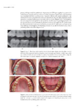 Updates on Caries Management in the Primary and Permanent Dentition 2025 - Image 9