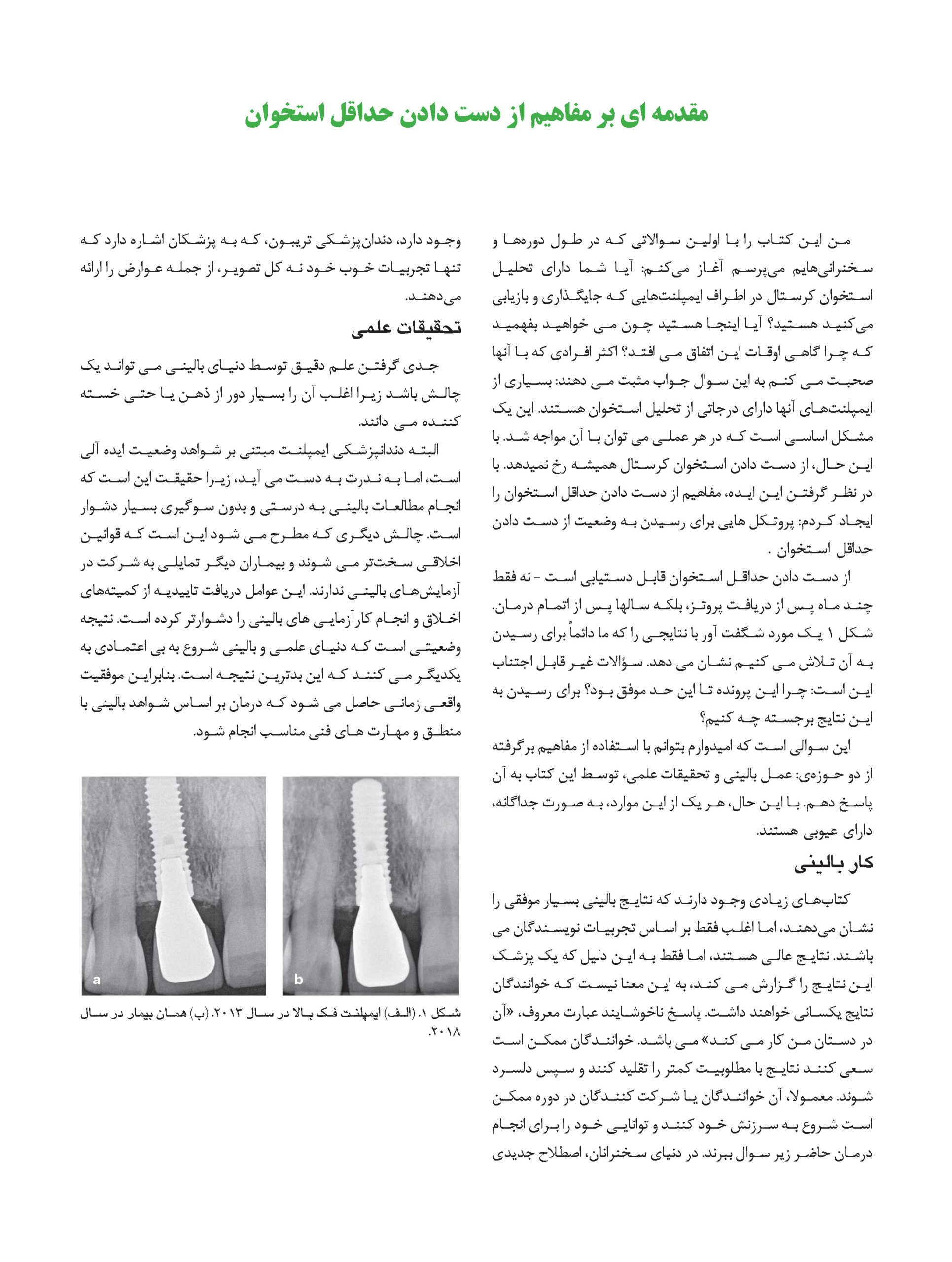 20Pages from راهبردهای جلوگیری از تحلیل استخوان در ایمپلنت_Page_05 راهبردهای جلوگیری از تحلیل استخوان در ایمپلنت - Image 9