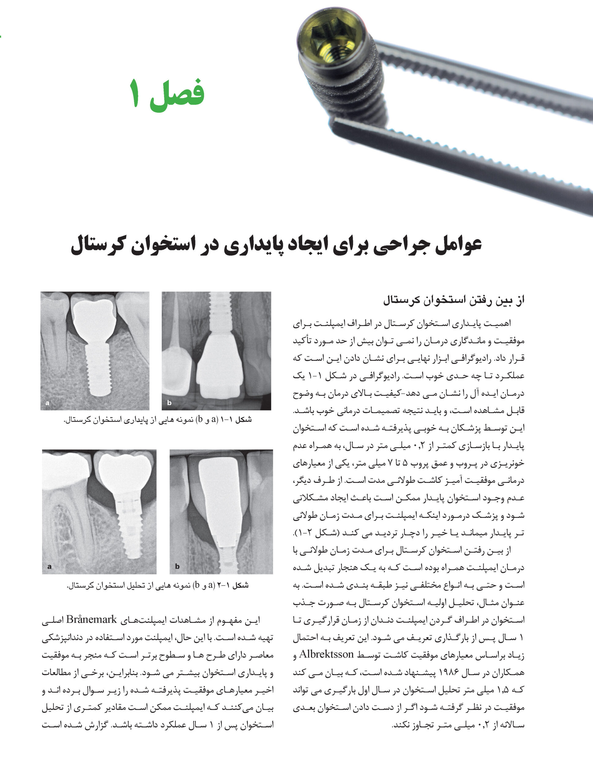 20Pages from راهبردهای جلوگیری از تحلیل استخوان در ایمپلنت_Page_12 راهبردهای جلوگیری از تحلیل استخوان در ایمپلنت - Image 4