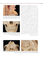 علم و هنر جراحی اندودانتیکس نوین - Image 8