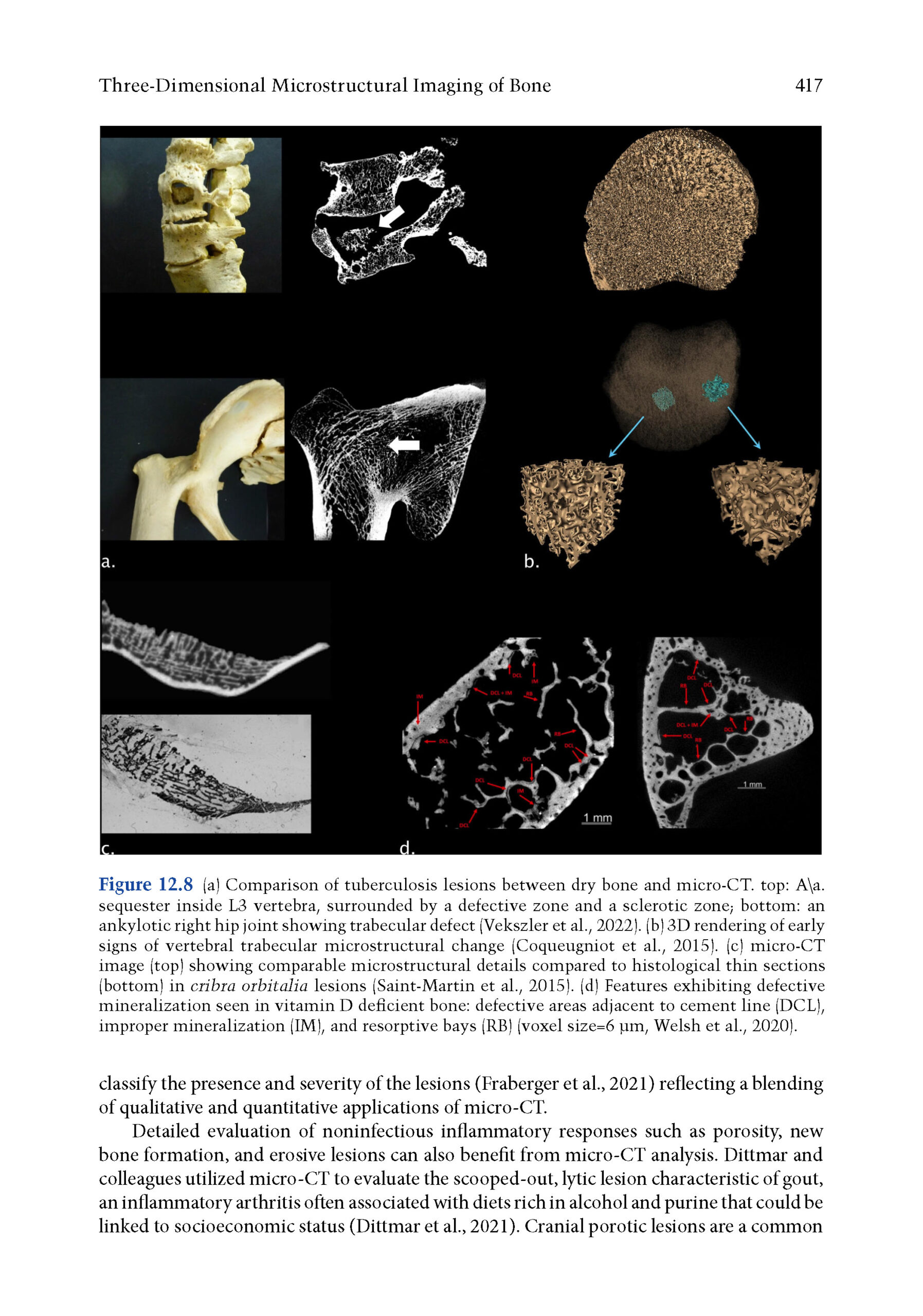 Bone Histology 2025_Page_6 Bone Histology: A Biological Anthropological Perspective 2025 (2nd Edition) - Image 2