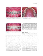 CLEAR ALIGNER TECHNIQUE 2025 (SECOND EDITION) - Image 2