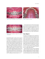 CLEAR ALIGNER TECHNIQUE 2025 (SECOND EDITION) - Image 2