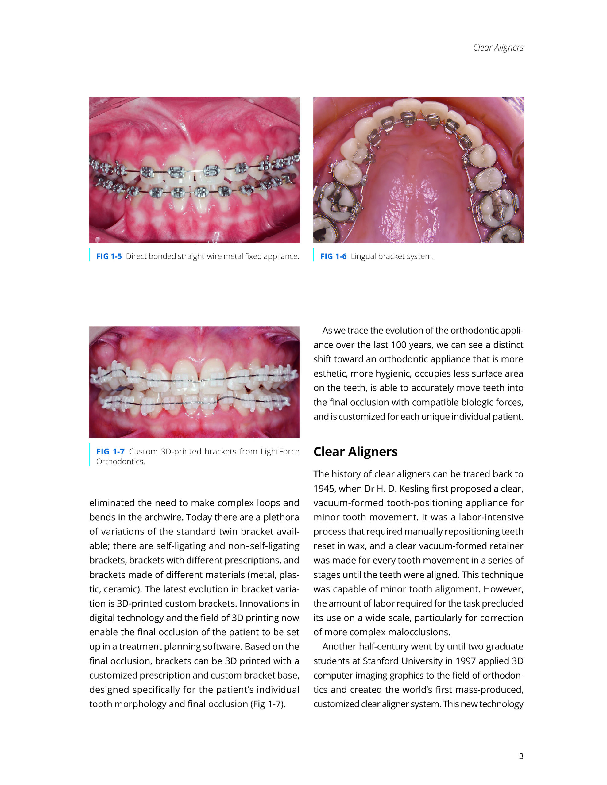 Clear Aligner Technique Second Edition_Page_2 CLEAR ALIGNER TECHNIQUE 2025 (SECOND EDITION) - Image 2