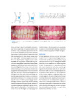 CLEAR ALIGNER TECHNIQUE 2025 (SECOND EDITION) - Image 3