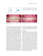 CLEAR ALIGNER TECHNIQUE 2025 (SECOND EDITION) - Image 3