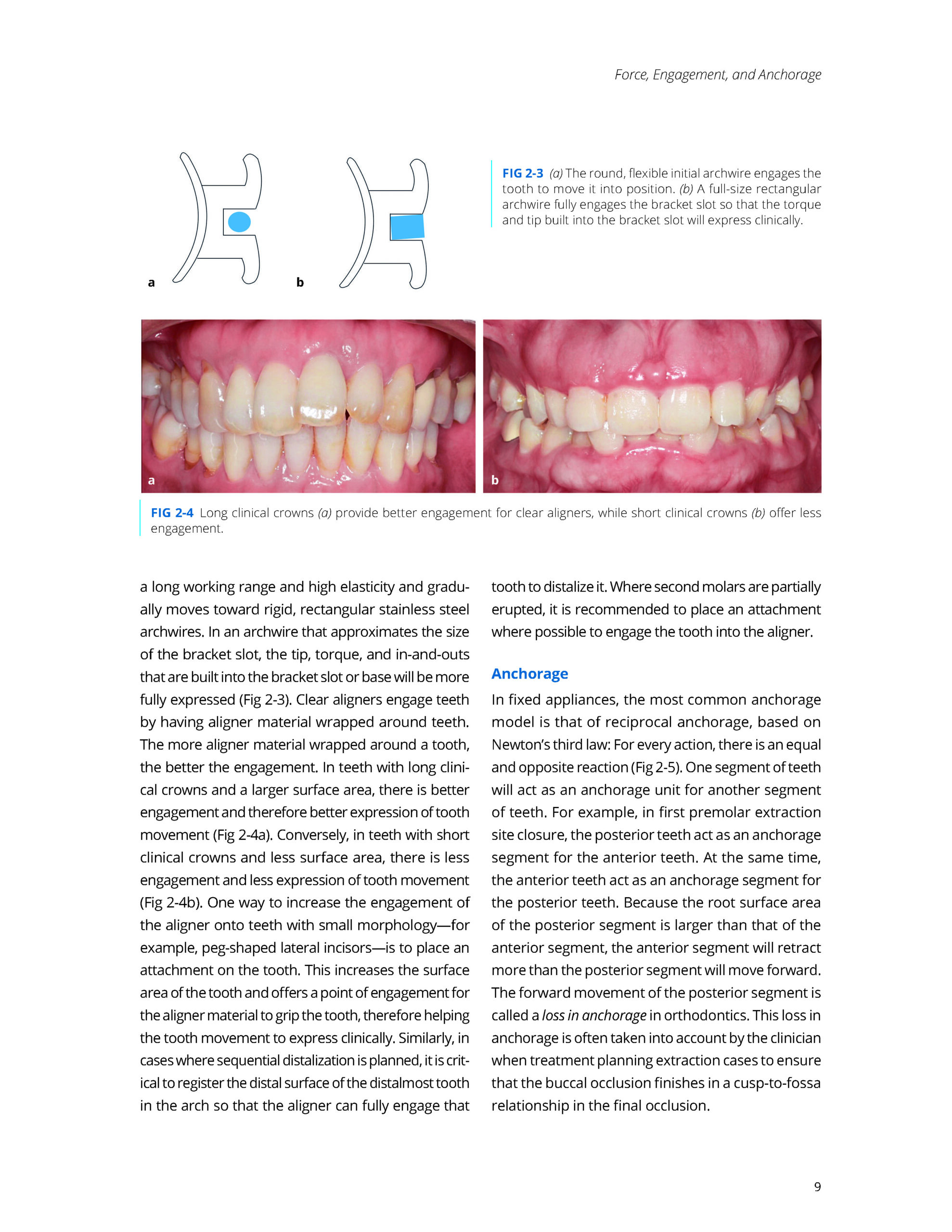 Clear Aligner Technique Second Edition_Page_3 CLEAR ALIGNER TECHNIQUE 2025 (SECOND EDITION) - Image 3