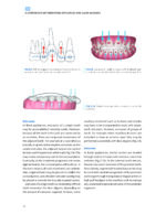 CLEAR ALIGNER TECHNIQUE 2025 (SECOND EDITION) - Image 5