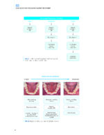 CLEAR ALIGNER TECHNIQUE 2025 (SECOND EDITION) - Image 7