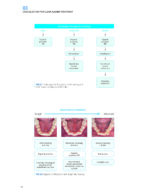CLEAR ALIGNER TECHNIQUE 2025 (SECOND EDITION) - Image 7