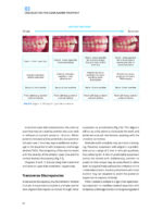 CLEAR ALIGNER TECHNIQUE 2025 (SECOND EDITION) - Image 8