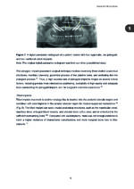 Clinical and Biomimetic Strategies for Dental Implantation in Insufficient Bone Volume Conditions 2025 - Image 2