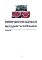 Clinical and Biomimetic Strategies for Dental Implantation in Insufficient Bone Volume Conditions 2025 - Image 3