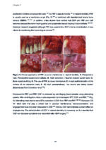 Clinical and Biomimetic Strategies for Dental Implantation in Insufficient Bone Volume Conditions 2025 - Image 4