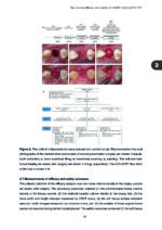 Clinical and Biomimetic Strategies for Dental Implantation in Insufficient Bone Volume Conditions 2025 - Image 6