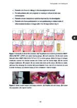 Clinical and Biomimetic Strategies for Dental Implantation in Insufficient Bone Volume Conditions 2025 - Image 7