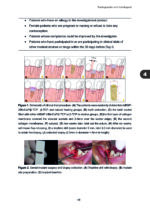 Clinical and Biomimetic Strategies for Dental Implantation in Insufficient Bone Volume Conditions 2025 - Image 7