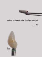 راهبردهای جلوگیری از تحلیل استخوان در ایمپلنت