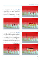 اطلس آموزشی جراحی های حفره دهان - Image 9