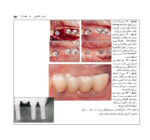 اطلس راهنمای گام به گام جراحی ایمپلنت در دندانپزشکی - Image 7