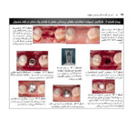 اطلس راهنمای گام به گام جراحی ایمپلنت در دندانپزشکی - Image 8
