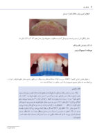 راهنمای بالینی درمان های رایج در دندانپزشکی کودکان - Image 10