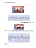 راهنمای بالینی درمان های رایج در دندانپزشکی کودکان - Image 11