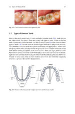 Analysis of Dental Imageries Towards Improved Diagnosis 2025 - Image 3