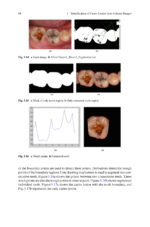 Analysis of Dental Imageries Towards Improved Diagnosis 2025 - Image 4