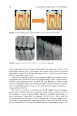 Analysis of Dental Imageries Towards Improved Diagnosis 2025 - Image 6