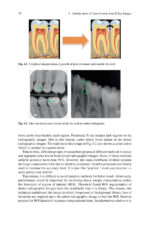 Analysis of Dental Imageries Towards Improved Diagnosis 2025 - Image 6
